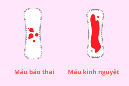TOP 7+ Kinh nghiệm ra máu báo thai thực tế giúp mẹ nhận biết chính xác nhất
